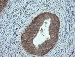 PMEL Antibody in Immunohistochemistry (Paraffin) (IHC (P))