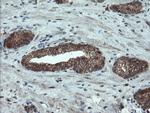 PMEL Antibody in Immunohistochemistry (Paraffin) (IHC (P))