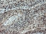 PMEL Antibody in Immunohistochemistry (Paraffin) (IHC (P))