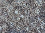 PMEL Antibody in Immunohistochemistry (Paraffin) (IHC (P))