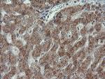 PMEL Antibody in Immunohistochemistry (Paraffin) (IHC (P))