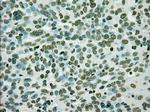 PMEL Antibody in Immunohistochemistry (Paraffin) (IHC (P))