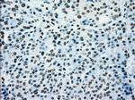 PMEL Antibody in Immunohistochemistry (Paraffin) (IHC (P))