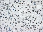 PMEL Antibody in Immunohistochemistry (Paraffin) (IHC (P))