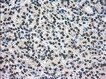 PMEL Antibody in Immunohistochemistry (Paraffin) (IHC (P))