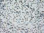 PMEL Antibody in Immunohistochemistry (Paraffin) (IHC (P))