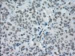 PMEL Antibody in Immunohistochemistry (Paraffin) (IHC (P))