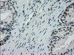 PMEL Antibody in Immunohistochemistry (Paraffin) (IHC (P))