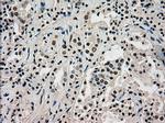 PMEL Antibody in Immunohistochemistry (Paraffin) (IHC (P))