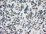 PMEL Antibody in Immunohistochemistry (Paraffin) (IHC (P))