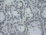 PMEL Antibody in Immunohistochemistry (Paraffin) (IHC (P))