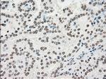 PMEL Antibody in Immunohistochemistry (Paraffin) (IHC (P))