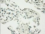 PMEL Antibody in Immunohistochemistry (Paraffin) (IHC (P))