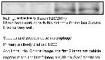 Phospho-MERTK (Tyr749, Tyr753, Tyr754) Antibody in Western Blot (WB)