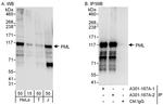 PML Antibody in Western Blot (WB)