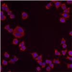 PMP70 Antibody in Immunocytochemistry (ICC/IF)