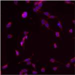 PMP70 Antibody in Immunocytochemistry (ICC/IF)