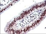 PMS2 Antibody in Immunohistochemistry (Paraffin) (IHC (P))