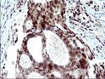 PMS2 Antibody in Immunohistochemistry (Paraffin) (IHC (P))