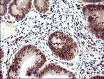 PMS2 Antibody in Immunohistochemistry (Paraffin) (IHC (P))