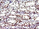 PMS2 Antibody in Immunohistochemistry (Paraffin) (IHC (P))