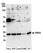 PMVK Antibody in Western Blot (WB)