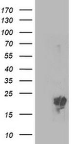 PMVK Antibody in Western Blot (WB)