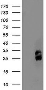 PMVK Antibody in Western Blot (WB)