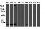 PMVK Antibody in Western Blot (WB)