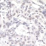 PNK1 Antibody in Immunohistochemistry (IHC)