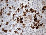 PNLIP Antibody in Immunohistochemistry (Paraffin) (IHC (P))