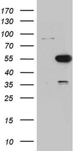 PNLIP Antibody in Western Blot (WB)