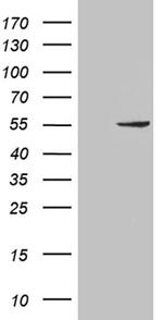 PNLIP Antibody in Western Blot (WB)