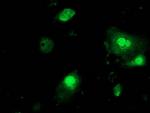 PNMT Antibody in Immunocytochemistry (ICC/IF)