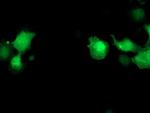 PNMT Antibody in Immunocytochemistry (ICC/IF)