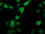 PNMT Antibody in Immunocytochemistry (ICC/IF)