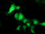 PNMT Antibody in Immunocytochemistry (ICC/IF)