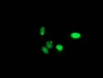 PNMT Antibody in Immunocytochemistry (ICC/IF)