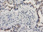 PNMT Antibody in Immunohistochemistry (Paraffin) (IHC (P))