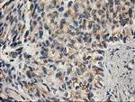 PNMT Antibody in Immunohistochemistry (Paraffin) (IHC (P))