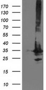 PNMT Antibody in Western Blot (WB)