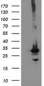 PNMT Antibody in Western Blot (WB)