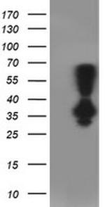 PNMT Antibody in Western Blot (WB)