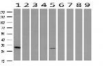 PNMT Antibody in Western Blot (WB)