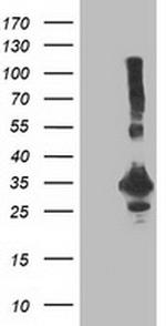 PNMT Antibody in Western Blot (WB)