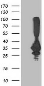 PNMT Antibody in Western Blot (WB)