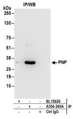 PNP Antibody in Western Blot (WB)