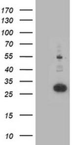 PNPO Antibody in Western Blot (WB)