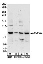 PNPase Antibody in Western Blot (WB)