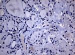 POLI Antibody in Immunohistochemistry (Paraffin) (IHC (P))